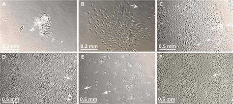 Images Of P P Primary Human Dermal Microvascular Endothelial Cells