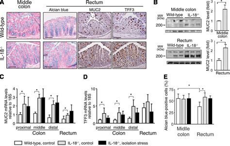 Goblet Cells And Expression Of Muc2 And Tff3 In Il 18 Mice A Colon Download Scientific