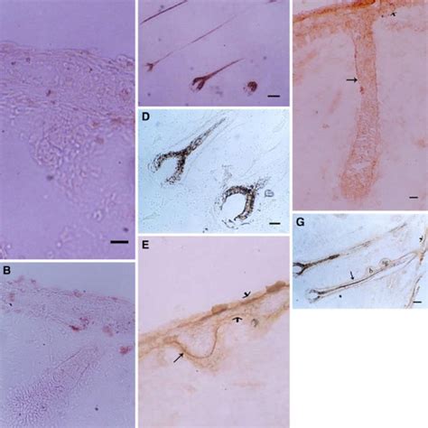 Histology of human hair follicle morphogenesis. Sections of the human ...