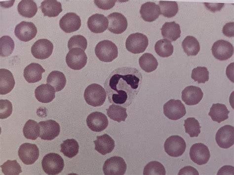 Normal WBC Morphology Atlas Chapter 5 Flashcards Quizlet