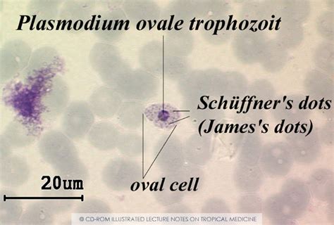 Plasmodium Ovale Medical Laboratories