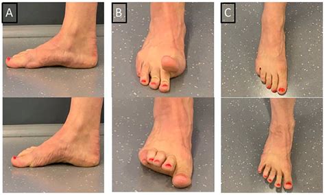 09 Tibialis Posterior