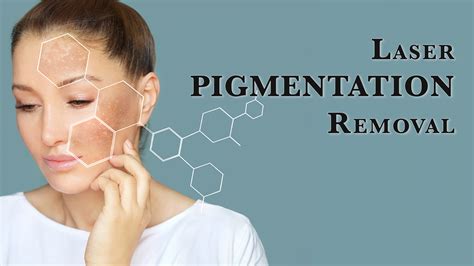 laser pigmentation removal orchard aesthetic clinic dr  aesthetics