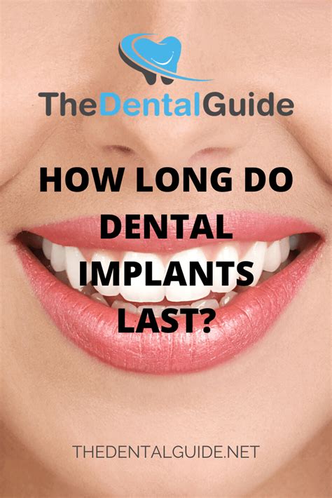 How Long Do Dental Implants Last The Dental Guide