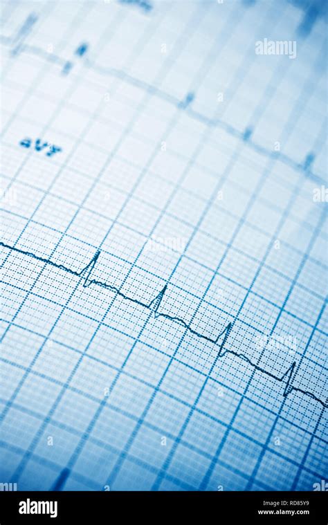 Close Up Of An Electrocardiogram In Paper Form Stock Photo Alamy