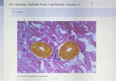 Solved PAL Histology Epithelial Tissue Lab SolutionInn