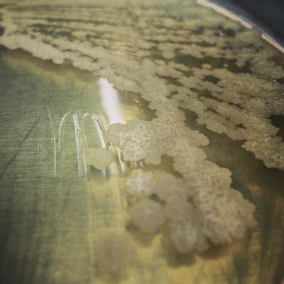 Mycobacterium smegmatis | Microchem Laboratory