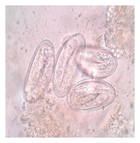 Hookworm Ova A Cyst Of Giardia Lamblia B Oocyst Of Isospora Belli Download Scientific