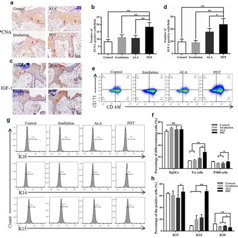 Aminolevulinic Acid Ala Photodynamic Therapy Pdt Promotes The