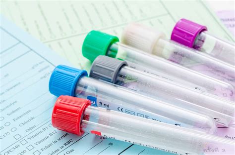 What You Need To Know About Health Screening Tests Chicago Health