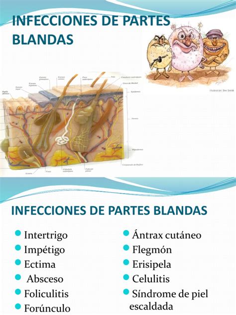 Infecciones De Partes Blandas Pdf Sistema Tegumentario