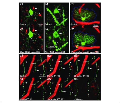 Astrocytes And Neurons Swell And Dendrites Bead In Response To