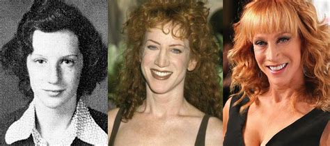 Kathy Griffin Plastic Surgery Before and After Pictures 2020