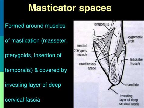 Ppt Neck Space Infections Powerpoint Presentation Id 302191