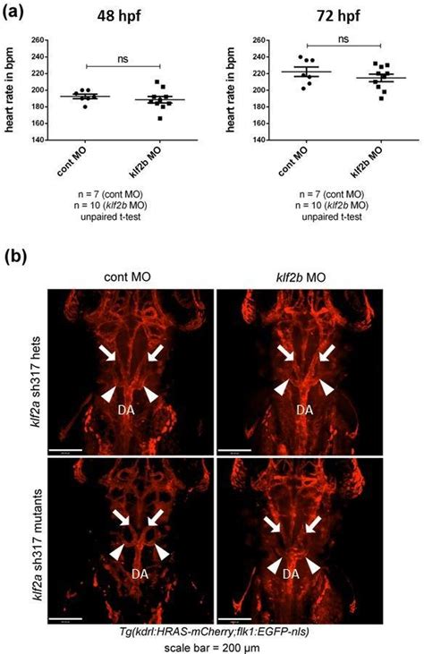 17 Comparison Of Heart Rates And AA5x Angiogenesis In Klf2b MO Injected