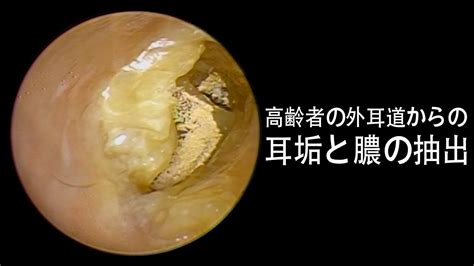 lump  ear filled  pus  allyson byerly blog