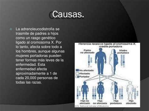 Ppt Adrenoleucodistrofia Ald Powerpoint Presentation Id