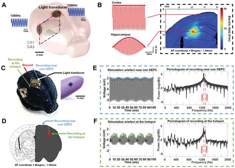 Laser‐driven Wireless Deep Brain Stimulation Using Temporal