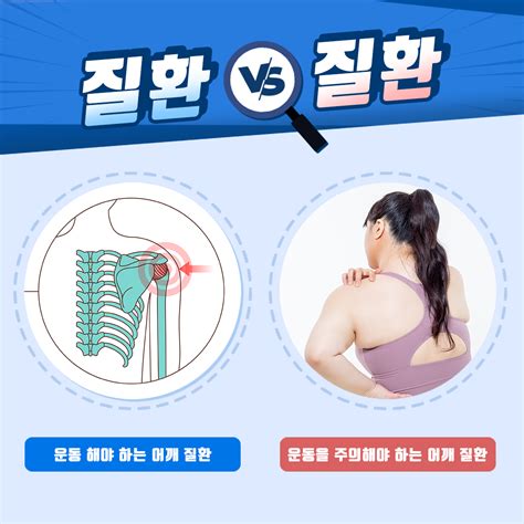 베스트 1021 어깨 통증 완화 운동 새로운 업데이트 50 분 전