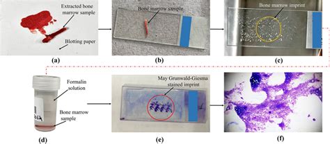 Pictorial Representation Of Pre And Post Processing Procedure Of