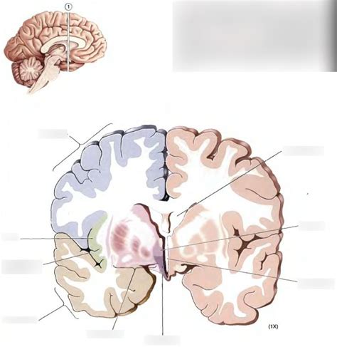 Forebrain Section At Thalamus Telencephalon Junction Gross Features