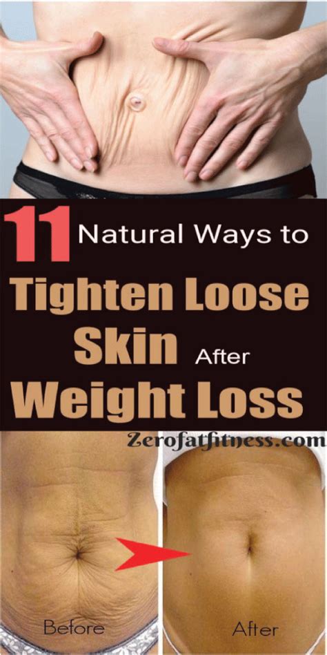 Incredible Is It Possible To Tighten Loose Skin On Stomach Without