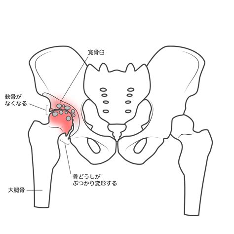 日常の動作に革命！股関節を柔軟にするヒップカーズエクササイズのすすめ｜安部元隆