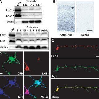 Expression Of LKB1 In The Developing Mouse Brain A Neocortical