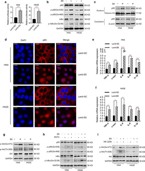 E Oncogene Activates Nf B And Akt Pathways In Hnscc A Nf B