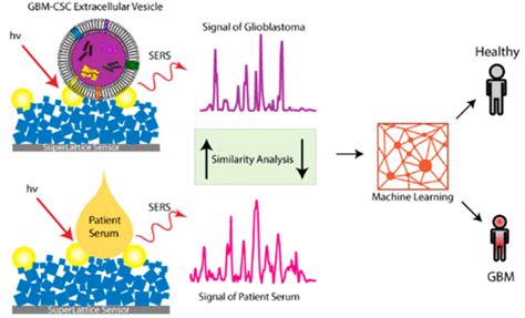 Self Functionalized Superlattice Nanosensor Enables Glioblastoma