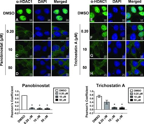 Hdaci Induced Re Equilibration Of Hdac Is Confirmed By Confocal