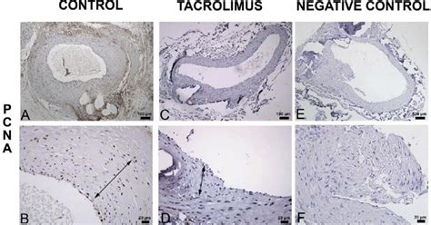 Proliferating Cell Nuclear Antigen Pcna Immunohistochemical Staining