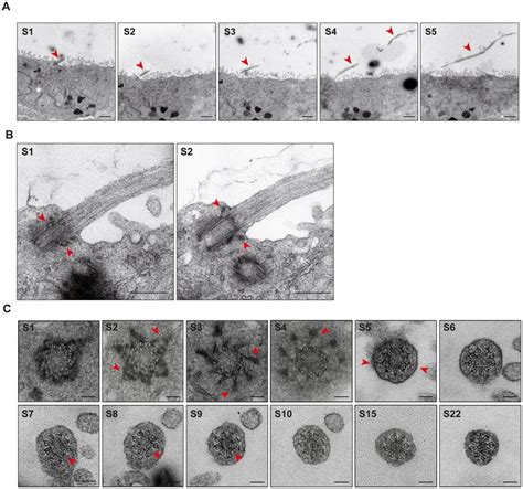 Ultrastructural Analysis Of A Long Primary Cilium Of Cav1α Ko Cells Download Scientific