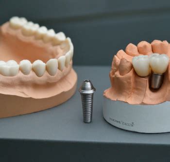 Riscos Biol Gicos E Ocupacionais Na Odontologia Dentalis