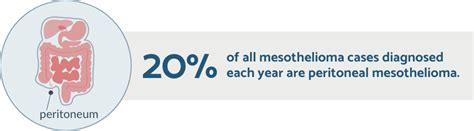 Peritoneal Mesothelioma, Mesothelioma Types | Mesothelioma Book