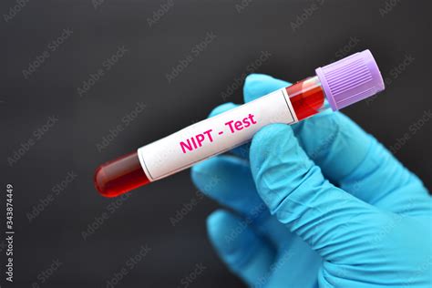 Blood Sample Tube For Nipt Test Or Non Invasive Prenatal Testing