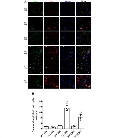 The Changes Of M2 Microglial Phenotypes In TG Mice At Different Time