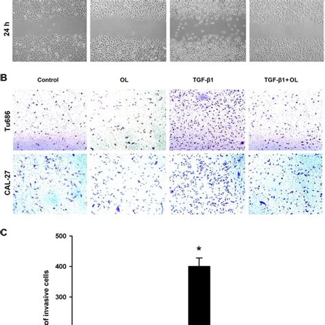 Ol Reversed The Migration And Invasion Of Tu And Cal Cells