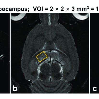 Representative Multi Slice T2 Weighted Magnetic Resonance MR Images