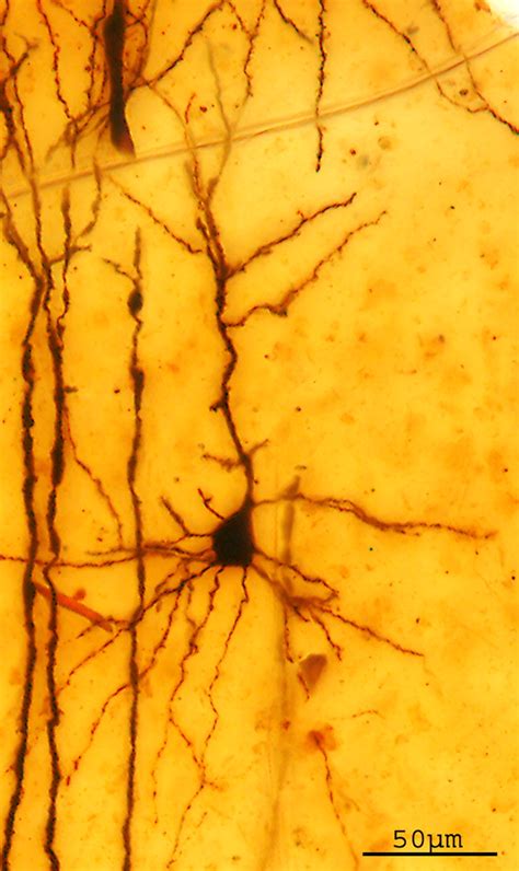 Pyramidal Cell Histology