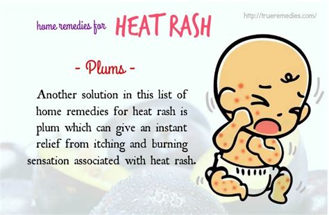 25 Home Remedies For Heat Rash On Face, Neck, Arms And Legs