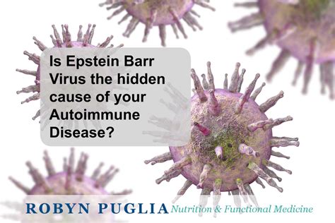 Epstein Barr Virus And Autoimmunity