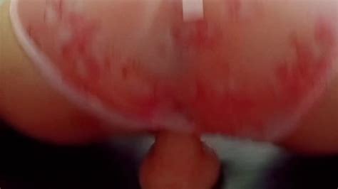 アナルとまんこ両方に極太ディルドとクリ用おもちゃを肛門にいれてみました Free Mobile Porn Videos iPornTV