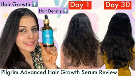 How I Went From Thin To Thick Hair In 30 Days Pilgrim Advanced Hair Growth Serum Review Youtube