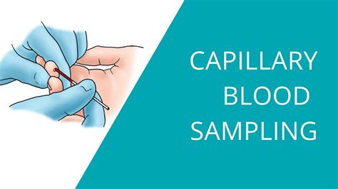 fill  capillary tube  oliver silas blog