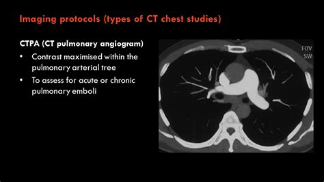 Radiology Quiz Radiopaedia Org Playlist Year