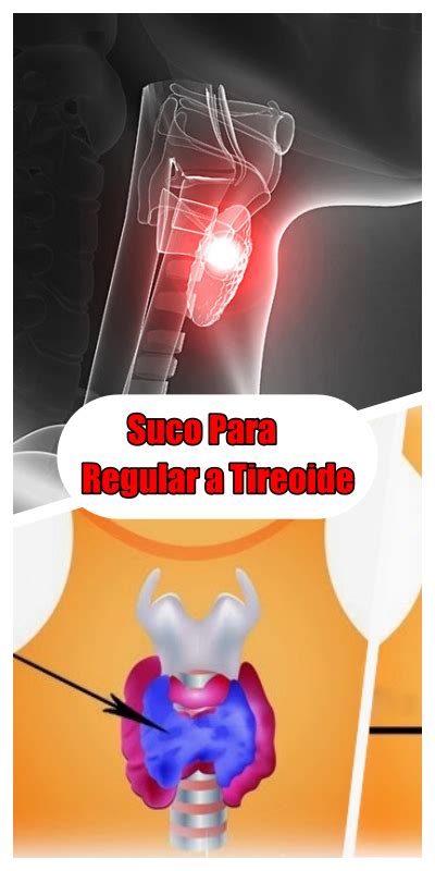 Beba Este Suco Para Regular A Tireoide Perder Peso E Combater