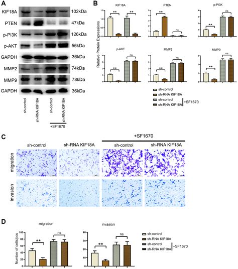 Kif18a Improves Migration And Invasion Of Colorectal Cancer Crc Cells