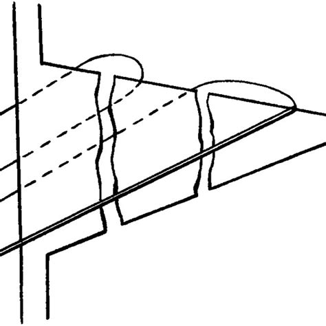 repair technique  multiple longitudinal tears  peripheral tear
