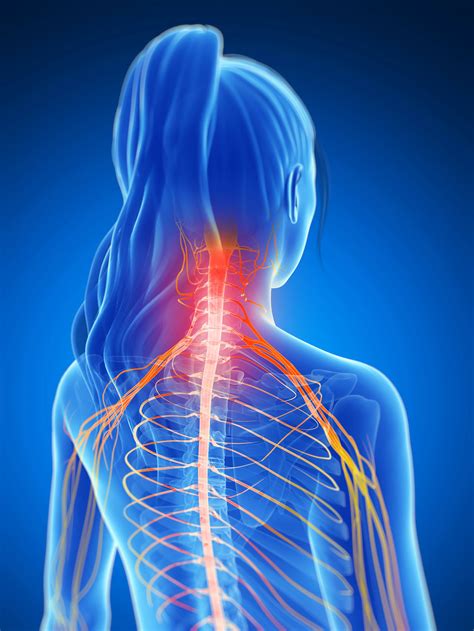 Neck & Upper Back Pain — Outline Health | Osteopath Farnham | Osteopath
